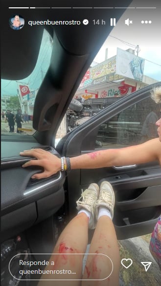 Daniela Buenrostro accidente: Aparece con heridas